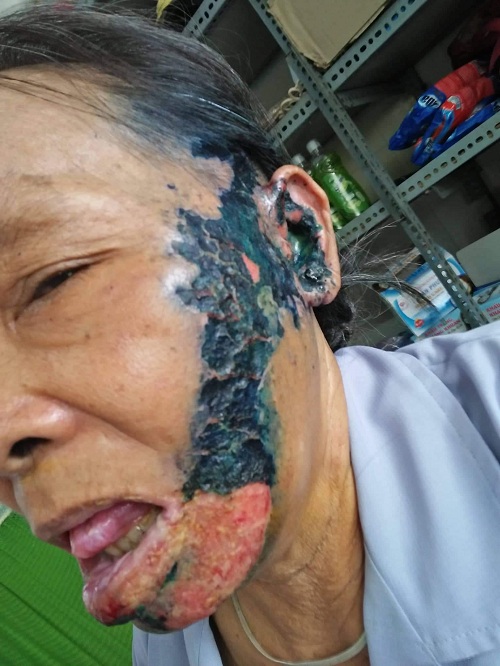 zona đong nai 1
