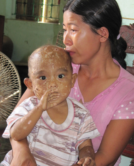 Hai đứa trẻ mắc bệnh lạ, răng đen kịt ở Nghệ An đã chữa khỏi - Chữa từ thiện